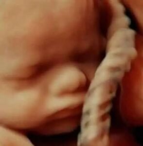 Echo in Rotterdam of omgeving laten maken?